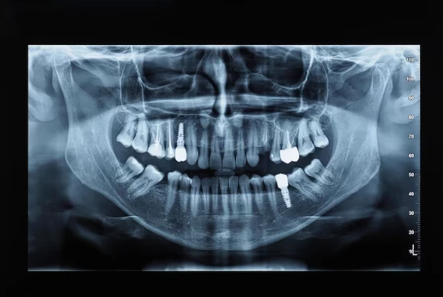 Advanced 3D Cone Beam CT Imaging